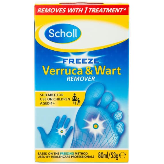 at home wart removal freeze